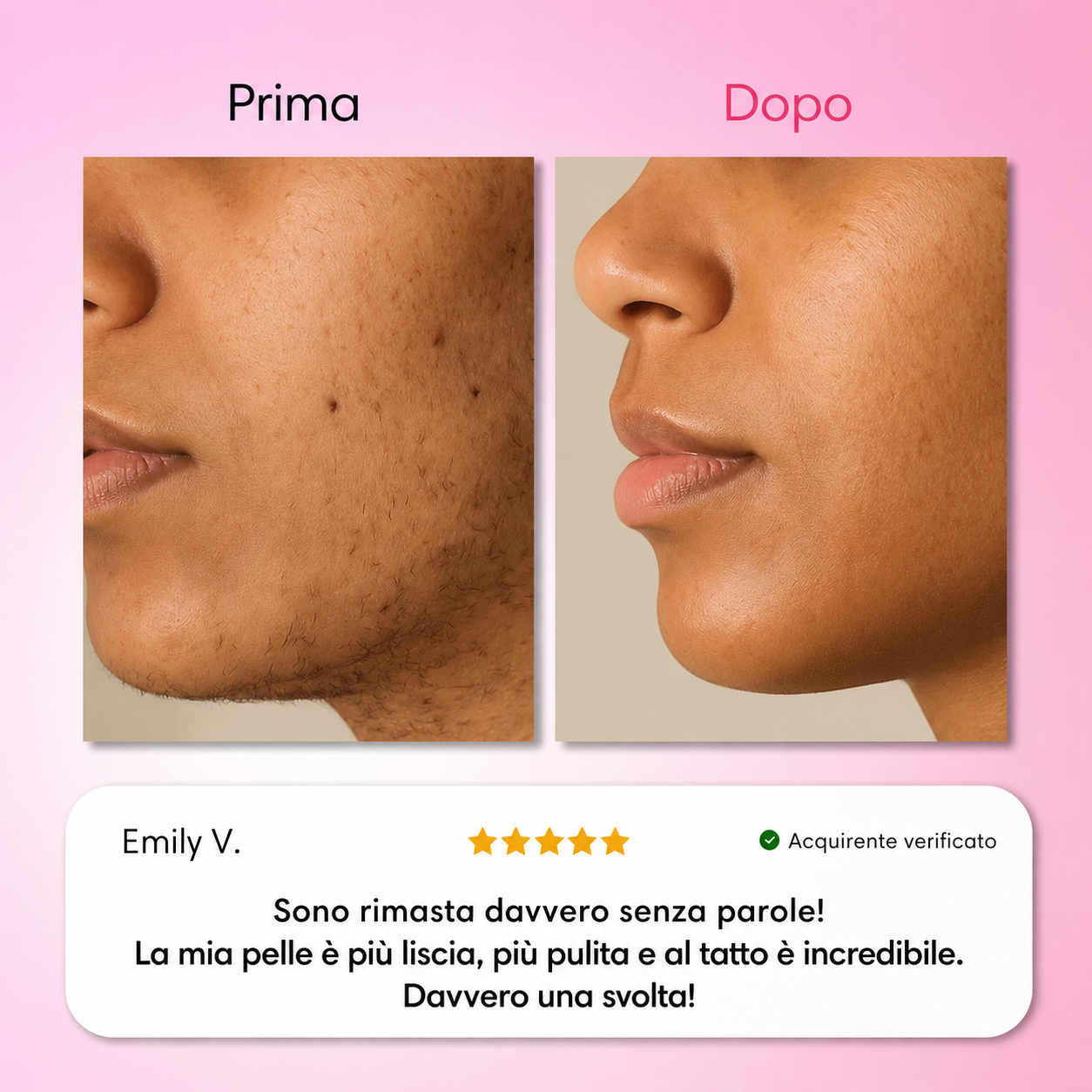 Dermelia - Kit Trilogy per la depilazione